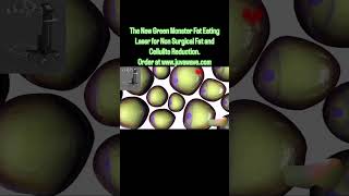 🧌The New Green Monster Fat and Cellulite Eating Laser plasticsurgery skincare weightloss [upl. by Heather]