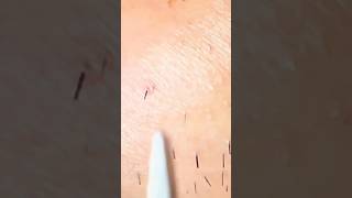 satisfying plucking relaxing tweezer [upl. by Layod]