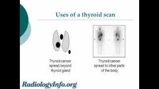 Your Radiologist Explains Thyroid Gland and Scan [upl. by Philly18]