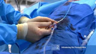 FFR Basics Performing an FFR Procedure  Mort Kern MD [upl. by Garaway]