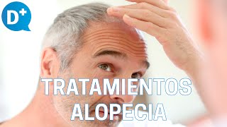 Los mejores tratamientos para combatir la alopecia [upl. by Teri677]