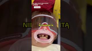 😍NIESAMOWITY DENTYSTA🦷😱 [upl. by Nattirb]