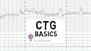 CTG Basics [upl. by Chun]