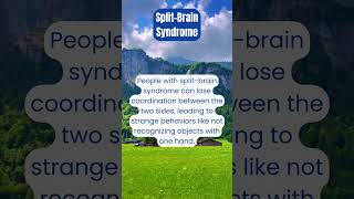 SplitBrain Syndrome The MindBlowing Truth About Two Brains [upl. by Elfie]