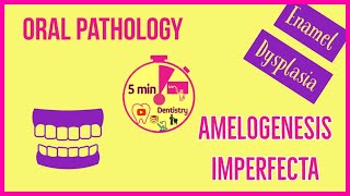 AMELOGENESIS IMPERFECTA  ORAL PATHOLOGY  easy notes  5minDentistry [upl. by Ellierim]