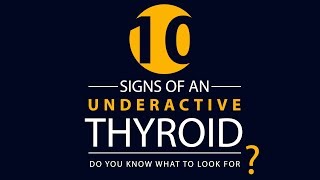 10 Signs of an UNDERACTIVE Thyroid [upl. by Cailean133]