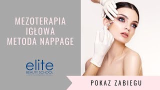 Mezoterapia igłowa  zabieg z wykorzystaniem metody nappage [upl. by Eidlog962]