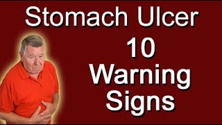 Stomach Ulcer  10 Warning Signs [upl. by Fredela]