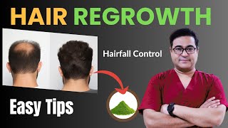 Guaranteed Hair Regrowth Tips by Dr Vikram  hairregrowth hairfall [upl. by Hgielrebmik821]