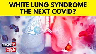 White Lung Syndrome  Mystery Illness Sparks Fear As Cases Rise Globally  English News  N18V [upl. by Weissman258]