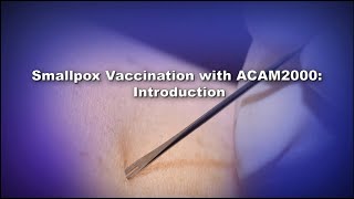 Chapter 1 Smallpox Vaccination with ACAM2000 Introduction [upl. by Neelra]