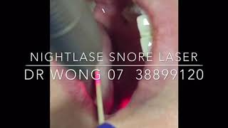 How to Snore Less using NightLase® [upl. by Gentes]