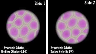 Study of Plasmolysis  MeitY OLabs [upl. by Scot]