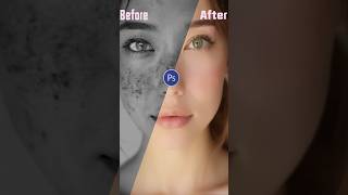 Adobe Photoshop 2025  ACNE Removing Technique ytshort shorts photoshoptutorial [upl. by Latsyrk]