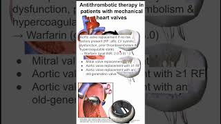 Antithrombotic therapy in patients with mechanical heart valves [upl. by Paolo]