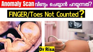 Anomaly Scan Malayalam  5th Month Pregnancy Scan [upl. by Sherri]