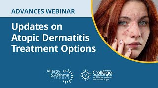 Updates on Atopic Dermatitis Treatment Options and the Role of Biologics [upl. by Yrehc574]