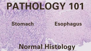 Normal Histology of Esophagus and Stomach  Pathology 101 GI Pathology [upl. by Adnaral]