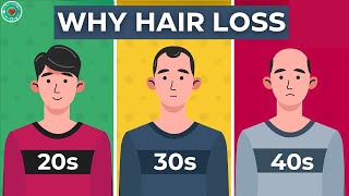 The REAL Causes of HAIR LOSS You Should Know [upl. by Maurey]