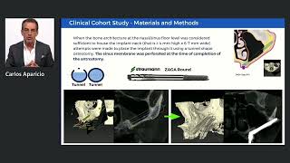 The Straumann® Zygomatic implant 2year clinical results Dr Carlos Aparicio [upl. by Held506]