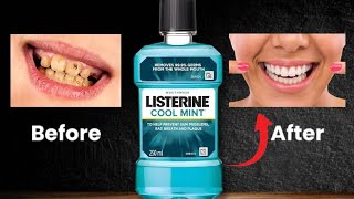 Listerine Mouthwash ❌ Cancer  Good Or Bad [upl. by Dnalerb]