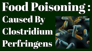 Clostridium Perfringens Food Poisoning [upl. by Atiuqehs]