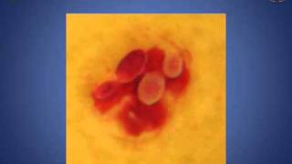 FAGOCITOSIS DE LEVADURAS POR NEUTRÓFILOS [upl. by Ahsel]