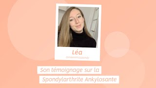 Spondylarthrite Ankylosante  Témoignage de Léa [upl. by Telfore]