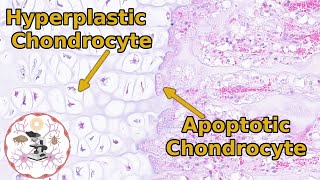 Epiphyseal Growth Plate Histology  Time to Zone Out [upl. by Aurelius]