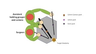 Learning Laparoscopic Sigmoid Colectomy High Anterior Resection [upl. by Meyers]