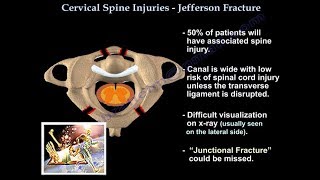 Jefferson Fracture  Everything You Need To Know  Dr Nabil Ebraheim [upl. by Gracye]