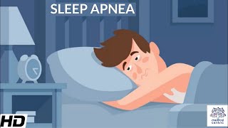 Sleep Apnea CausesSigns and Symptoms DIagnosis and Treatment [upl. by Valdemar]