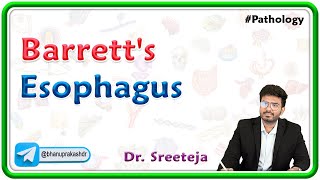 6 Barretts Esophagus  USMLE Step 1 Pathology [upl. by Brittaney798]