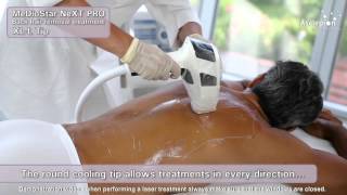 MeDioStar NeXT PRO XL  Training video for hair removal with SMOOTHPULSE mode from Asclepion [upl. by Schlicher]