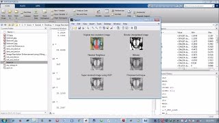 Image Resolution Enhancement using Lifting Wavelet and Stationary Wavelet IEEE project Matlab code [upl. by Mehala]