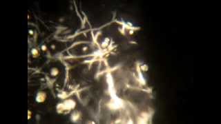 MUST SEE Proof quotBiologicalquot Tracking in Consumer GoodsHeavy Metals Transhumanism Morgellons [upl. by Aisya24]