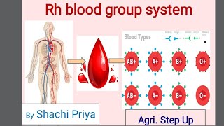 Rh blood grouping system Inheritance of Rh factor Rh incompatibility Erythroblastosis fetalis [upl. by Olraced]