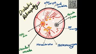 Retinal Abnormalities findings in Ophthalmoscope Examination  Made Easy   مشاكل الشبكية [upl. by Ahsiuqal178]