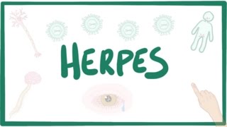 Herpes oral amp genital  causes symptoms diagnosis treatment pathology [upl. by Haduj]