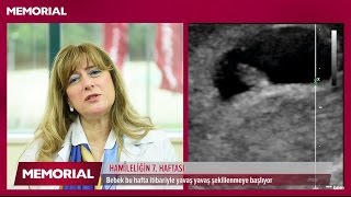 7 haftalık gebelik döneminde neler oluyor [upl. by Idurt275]