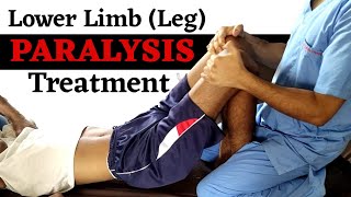 lower limb paralysis treatment  lower limb paralysis physiotherapy treatment  paralysis treatment [upl. by Cirillo32]