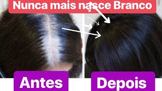 CABELO BRANCO fica PRETO PRA SEMPRE nunca mais NASCE BRANCO GARANTO [upl. by Nauqes656]