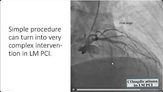 Consequences of inadequate anticoagulation and noreflow phenomenon in left main stenting [upl. by Harias936]