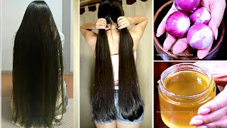 1 Week Challenge  Grow Your Hair Super Faster  After Doing this Your Hair will Never Stop Growing [upl. by Arlette634]