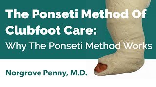 The Ponseti Method Of Clubfoot Care Why The Ponseti Method Works [upl. by Aseral]