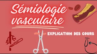 semiologie vasculaire  explication facile [upl. by Aylmar]