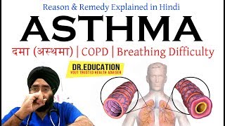 Cure Asthma दमा अस्थमा COPD  Breathing Difficulty  Cough in Hindi DrEDUCATION [upl. by Eeloj222]