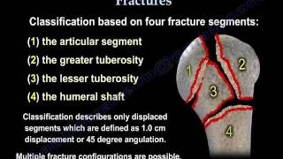 Proximal Humerus Fractures classification  Everything You Need To Know  Dr Nabil Ebraheim [upl. by Ludeman]