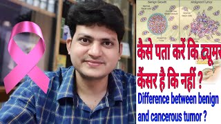 कैसे पता करें कि ट्यूमर कैंसर है कि नहीं  Difference between benign tumor and cancer tumor [upl. by Crandall]