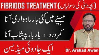 Fibroids CausesSymptoms And Treatment In Urdu [upl. by Tally]